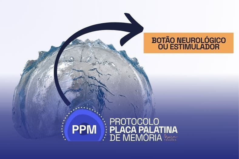 Como escolher o botão lingual para cada anatomia
