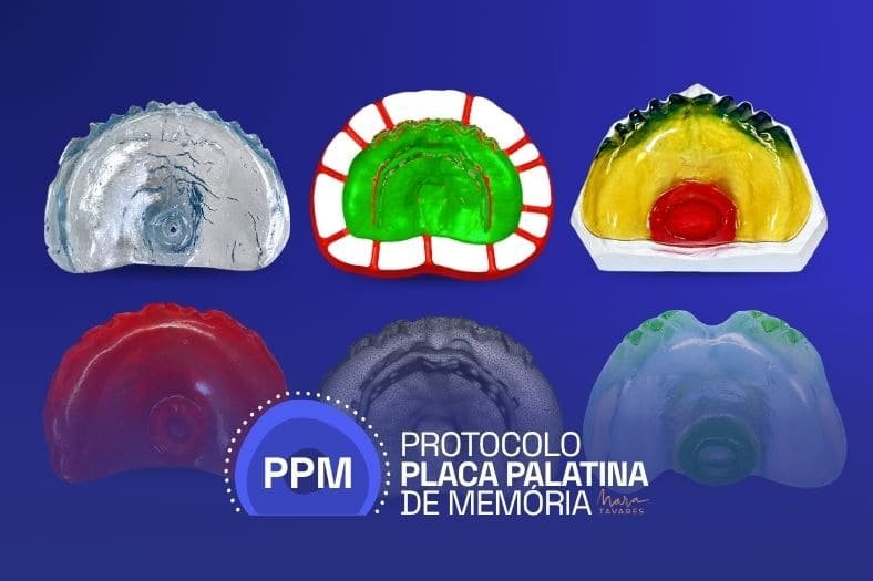 Como o desenho da placa produz estímulos diferentes