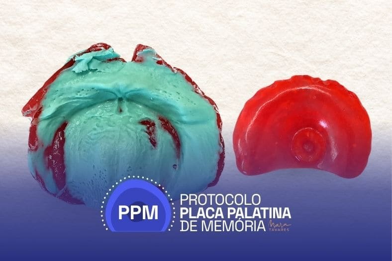 Da moldagem à instalação em bebês