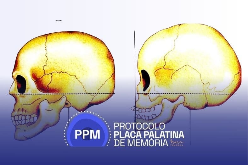 O que observar antes de pensar na placa